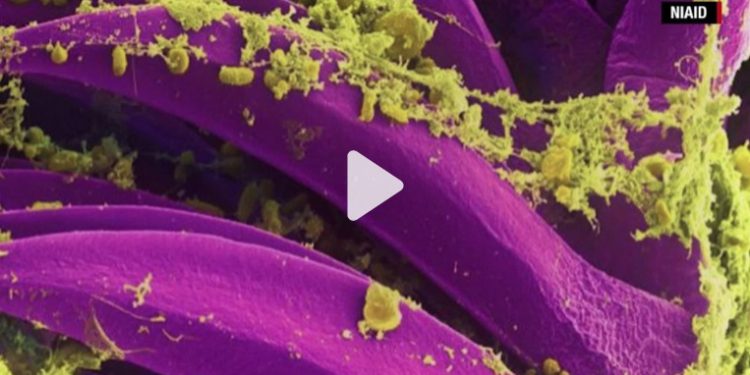 Chinese authorities confirm bubonic plague in Inner Mongolia